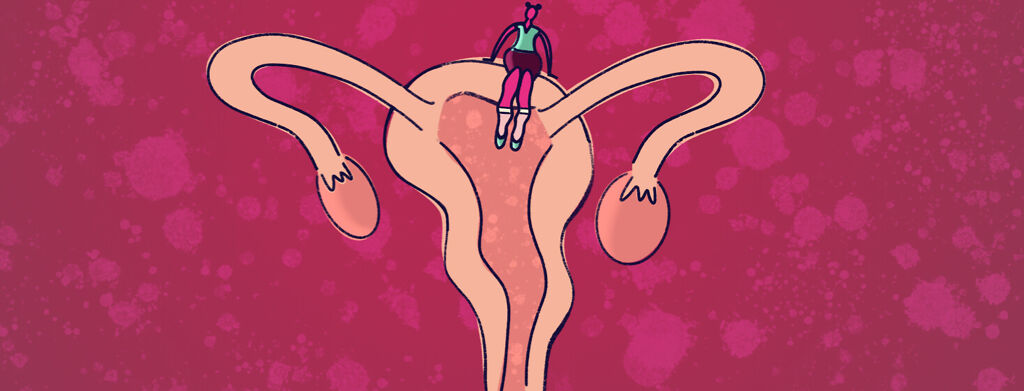Is It Perimenopause Or Just My Endometriosis? image